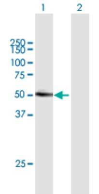 Western Blot: Lipase I Antibody [H00149998-B01P]