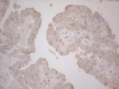 Immunohistochemistry: Lipin 1 Antibody (OTI5B5) [NBP2-45671]