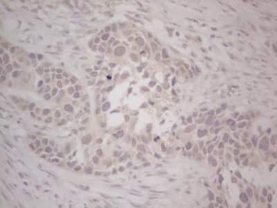Immunohistochemistry: Lipin 1 Antibody (OTI5B5) [NBP2-45671]