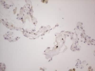 Immunohistochemistry: Lipin 1 Antibody (OTI5B5) [NBP2-45671]