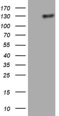 Western Blot: Lipin 1 Antibody (OTI5B5) [NBP2-45671]