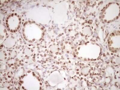 Immunohistochemistry: Lipin 1 Antibody (OTI8F10) [NBP2-45670]