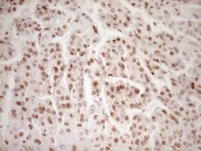 Immunohistochemistry: Lipin 1 Antibody (OTI8F10) [NBP2-45670]