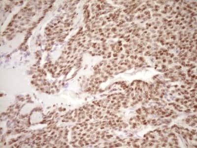 Immunohistochemistry: Lipin 1 Antibody (OTI8F10) [NBP2-45670]