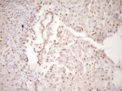 Immunohistochemistry: Lipin 1 Antibody (OTI8F10) [NBP2-45670]