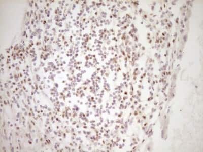 Immunohistochemistry: Lipin 1 Antibody (OTI8F10) [NBP2-45670]