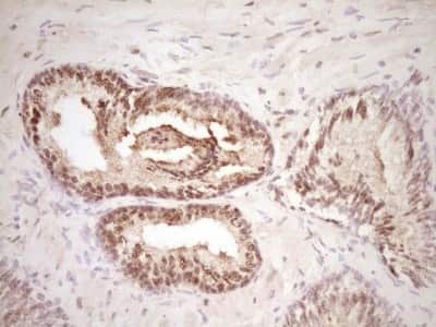 Immunohistochemistry: Lipin 1 Antibody (OTI8F10) [NBP2-45670]
