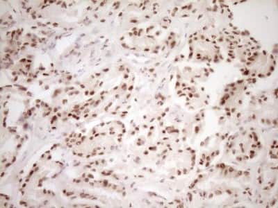 Immunohistochemistry: Lipin 1 Antibody (OTI8F10) [NBP2-45670]