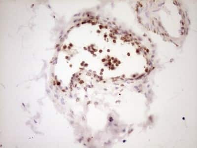 Immunohistochemistry: Lipin 1 Antibody (OTI8F10) [NBP2-45670]