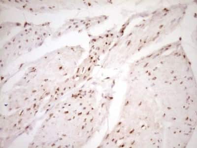 Immunohistochemistry: Lipin 1 Antibody (OTI8F10) [NBP2-45670]
