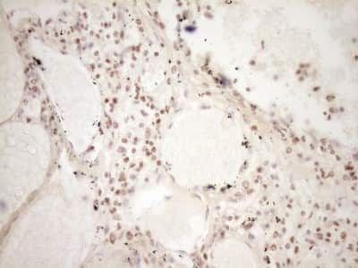 Immunohistochemistry: Lipin 1 Antibody (OTI8F10) [NBP2-45670]