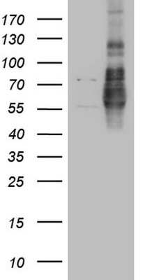 Western Blot: Lipin 1 Antibody (OTI8F10) [NBP2-45670]