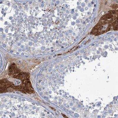 Immunohistochemistry-Paraffin: Lipin 1 Antibody [NBP1-83030]