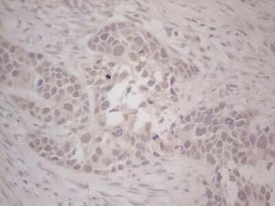 Immunohistochemistry: Lipin 1 Antibody (OTI5B5) - Azide and BSA Free [NBP2-71727]