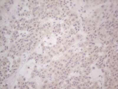 Immunohistochemistry: Lipin 1 Antibody (OTI5B5) - Azide and BSA Free [NBP2-71727]