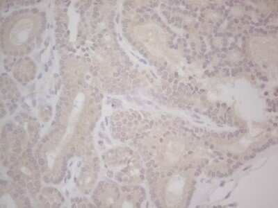 Immunohistochemistry: Lipin 1 Antibody (OTI5B5) - Azide and BSA Free [NBP2-71727]