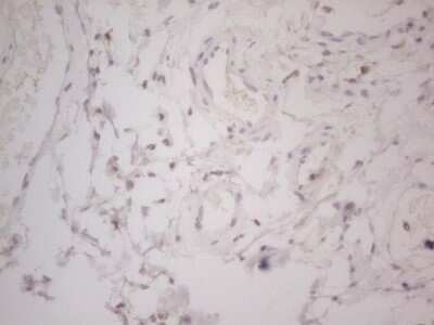 Immunohistochemistry: Lipin 1 Antibody (OTI5B5) - Azide and BSA Free [NBP2-71727]