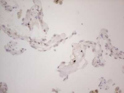 Immunohistochemistry: Lipin 1 Antibody (OTI5B5) - Azide and BSA Free [NBP2-71727]