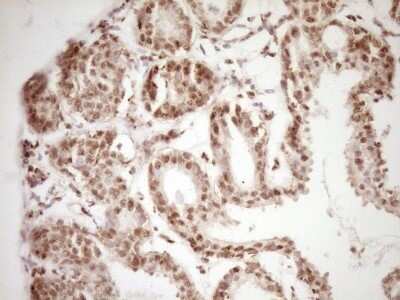 Immunohistochemistry: Lipin 1 Antibody (OTI8F10) - Azide and BSA Free [NBP2-71726]