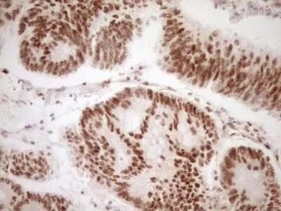 Immunohistochemistry: Lipin 1 Antibody (OTI8F10) - Azide and BSA Free [NBP2-71726]