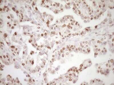 Immunohistochemistry: Lipin 1 Antibody (OTI8F10) - Azide and BSA Free [NBP2-71726]
