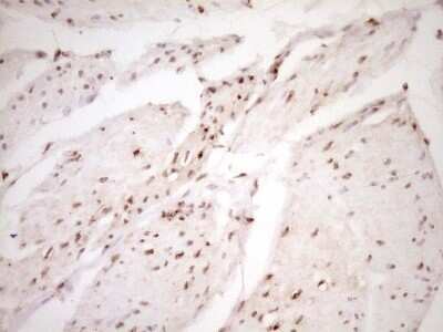 Immunohistochemistry: Lipin 1 Antibody (OTI8F10) - Azide and BSA Free [NBP2-71726]