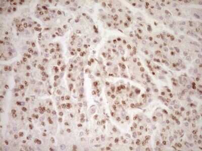 Immunohistochemistry: Lipin 1 Antibody (OTI8F10) - Azide and BSA Free [NBP2-71726]