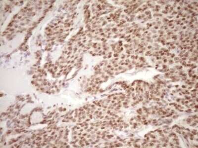 Immunohistochemistry: Lipin 1 Antibody (OTI8F10) - Azide and BSA Free [NBP2-71726]