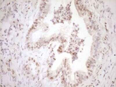Immunohistochemistry: Lipin 1 Antibody (OTI8F10) - Azide and BSA Free [NBP2-71726]