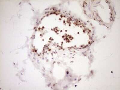 Immunohistochemistry: Lipin 1 Antibody (OTI8F10) - Azide and BSA Free [NBP2-71726]