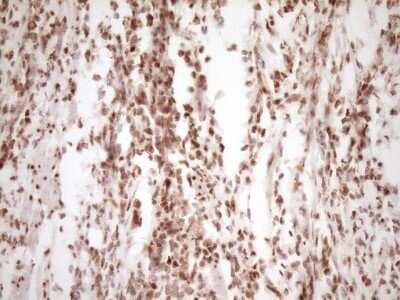 Immunohistochemistry: Lipin 1 Antibody (OTI8F10) - Azide and BSA Free [NBP2-71726]