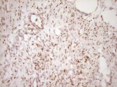 Immunohistochemistry: Lipin 1 Antibody (OTI8F10) - Azide and BSA Free [NBP2-71726]