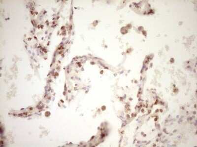 Immunohistochemistry: Lipin 1 Antibody (OTI8F10) - Azide and BSA Free [NBP2-71726]