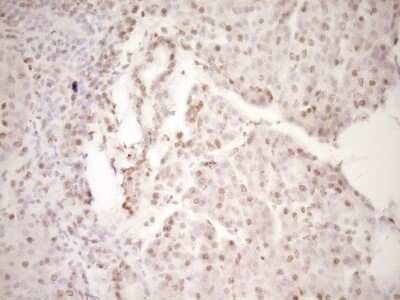 Immunohistochemistry: Lipin 1 Antibody (OTI8F10) - Azide and BSA Free [NBP2-71726]