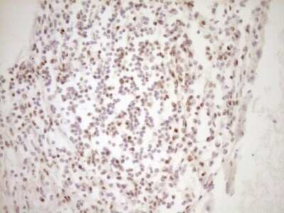 Immunohistochemistry: Lipin 1 Antibody (OTI8F10) - Azide and BSA Free [NBP2-71726]