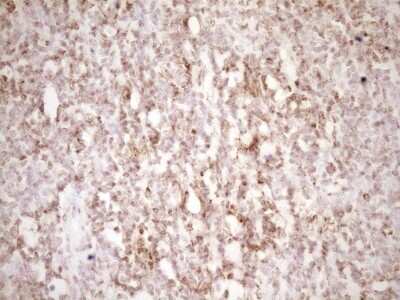 Immunohistochemistry: Lipin 1 Antibody (OTI8F10) - Azide and BSA Free [NBP2-71726]