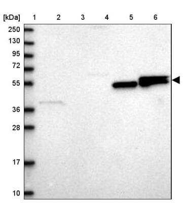 Western Blot: Lipin 1 Antibody [NBP1-83030]