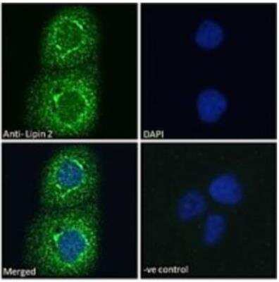 Immunocytochemistry/ Immunofluorescence: Lipin 2 Antibody [NBP3-00525]