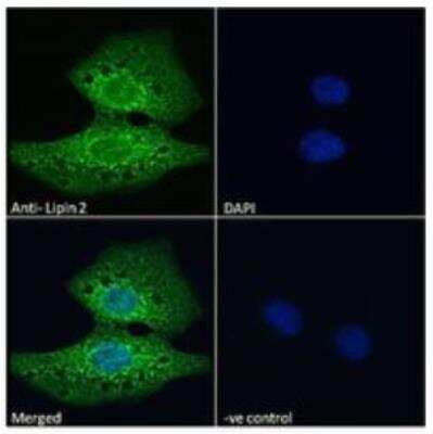 Immunocytochemistry/ Immunofluorescence: Lipin 2 Antibody [NBP3-00525]