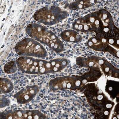 Immunohistochemistry-Paraffin: Lipin 2 Antibody [NBP1-87853]