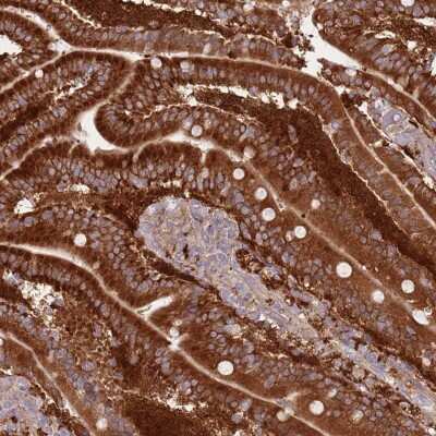 Immunohistochemistry-Paraffin: Lipin 2 Antibody [NBP2-33931]