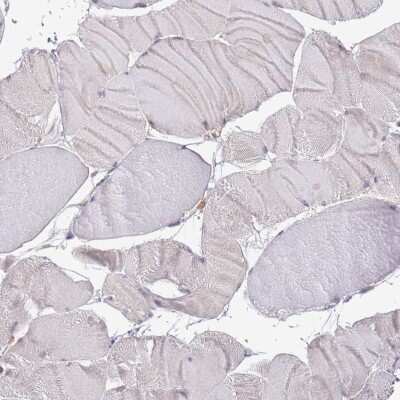 Immunohistochemistry-Paraffin: Lipin 2 Antibody [NBP2-33931]