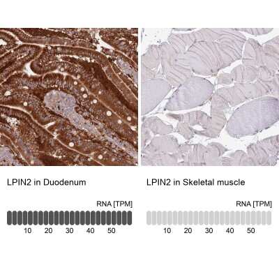 Immunohistochemistry-Paraffin: Lipin 2 Antibody [NBP2-33931]