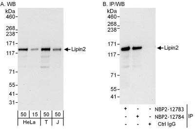 Immunoprecipitation: Lipin 2 Antibody [NBP2-12783]