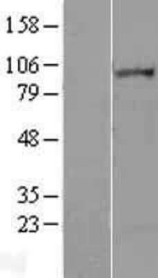 Western Blot: Lipin 2 Overexpression Lysate [NBL1-12654]