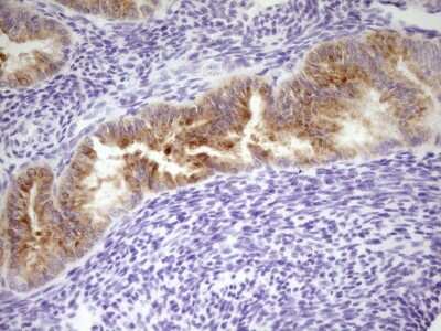 Immunohistochemistry: Lipin 3 Antibody (OTI1D7) [NBP2-45672]