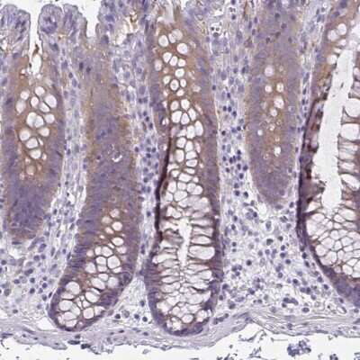 Immunohistochemistry-Paraffin: Lipin 3 Antibody [NBP2-31920]