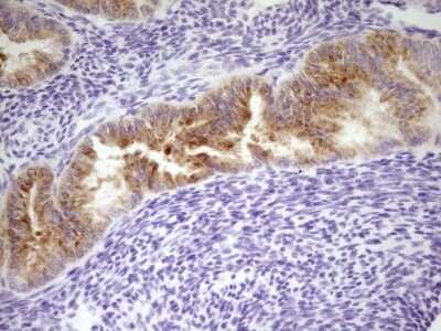 Immunohistochemistry: Lipin 3 Antibody (OTI1D7) - Azide and BSA Free [NBP2-72160]