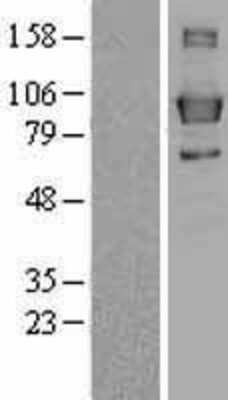 Western Blot: Lipin 3 Overexpression Lysate [NBL1-12655]