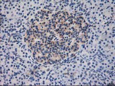 Immunohistochemistry-Paraffin: Dihydrolipoamide Dehydrogenase/DLD Antibody (OTI6D5) [NBP2-01109]
